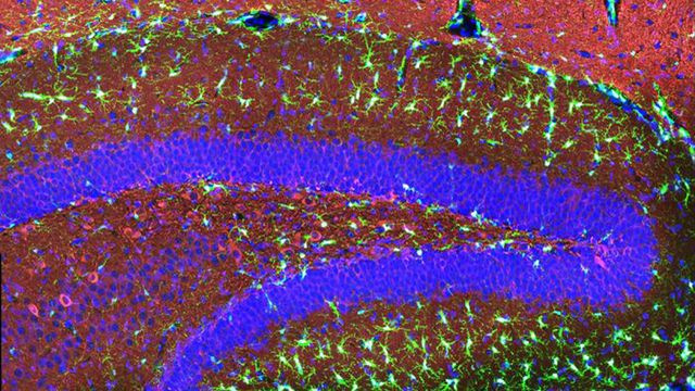 Human microglia implanted in the hippocampus region of the brain of a mouse. 